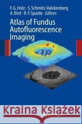 Atlas of Fundus Autofluorescence Imaging  9783540719939 SPRINGER-VERLAG BERLIN AND HEIDELBERG GMBH & 