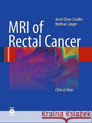 mri of rectal cancer: clinical atlas  Schäfer, Arnd-Oliver 9783540728320 Springer