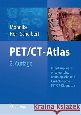 Oncologic and Cardiologic Pet/Ct-Diagnosis: An Interdisciplinary Atlas and Manual [With DVD ROM] Mohnike, Wolfgang 9783540740902 Not Avail