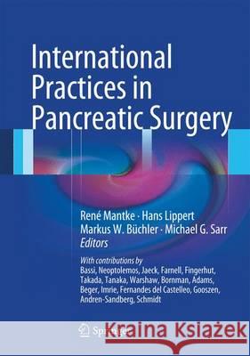 International Practices in Pancreatic Surgery Rene Mantke 9783540745051