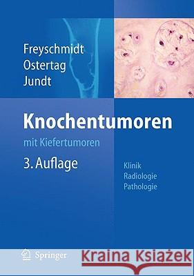Knochentumoren Mit Kiefertumoren: Klinik - Radiologie - Pathologie Freyschmidt, Jürgen 9783540751526 Springer
