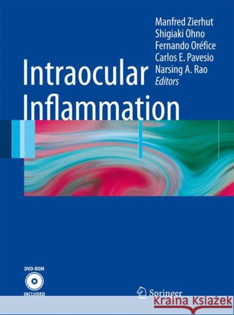 Intraocular Inflammation Manfred Zierhut 9783540753858