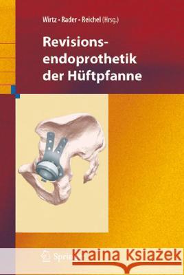 Revisionsendoprothetik Der Hüftpfanne Wirtz, Dieter C. 9783540756484 Springer