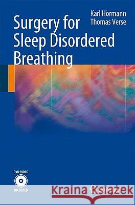 Surgery for Sleep Disordered Breathing [With DVD] Hörmann, Karl 9783540777854