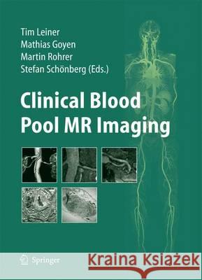 Clinical Blood Pool MR Imaging Tim Leiner Matthias Goyen Stefan Sch??nberg 9783540778608 Springer