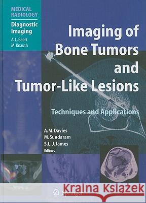 Imaging of Bone Tumors and Tumor-Like Lesions: Techniques and Applications Davies, A. Mark 9783540779827