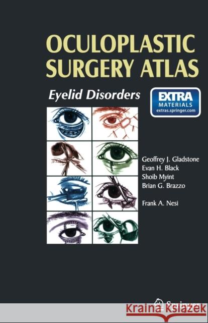 Oculoplastic Surgery Atlas: Eyelid Disorders Nesi, Frank A. 9783540781066