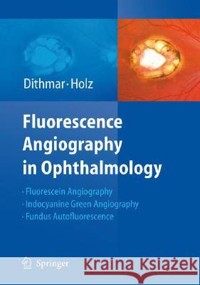 Fluorescence Angiography in Ophthalmology Stefan Dithmar, Frank G. Holz 9783540783596