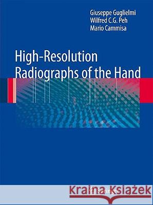 High-Resolution Radiographs of the Hand Giuseppe Guglielmi Wilfred C. G. Peh 9783540794790 Springer
