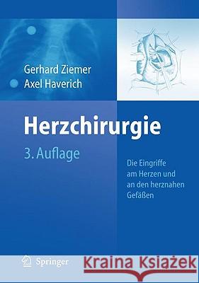 Herzchirurgie: Die Eingriffe Am Herzen Und an Den Herznahen Gefäßen Ziemer, Gerhard 9783540797128 Springer, Berlin