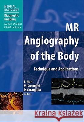 MR Angiography of the Body: Technique and Clinical Applications Neri, Emanuele 9783540797166 SPRINGER-VERLAG BERLIN AND HEIDELBERG GMBH & 