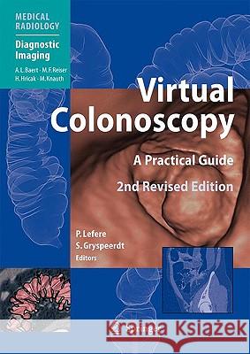 Virtual Colonoscopy: A Practical Guide Baert, Albert L. 9783540798798 Springer