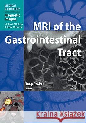 MRI of the Gastrointestinal Tract Jaap Stoker 9783540855316 Springer-Verlag Berlin and Heidelberg GmbH & 