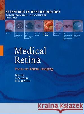 Medical Retina: Focus on Retinal Imaging Frank G Holz, Richard F. Spaide 9783540855392 Springer-Verlag Berlin and Heidelberg GmbH & 