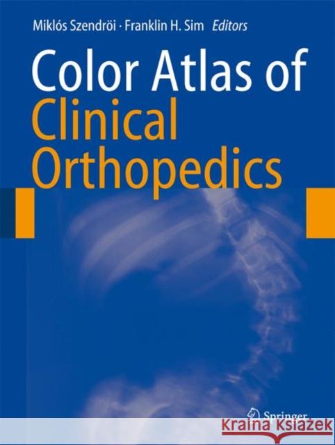 Color Atlas of Clinical Orthopedics Mikla3s Szendrai Franklin H. Sim 9783540855606 Springer