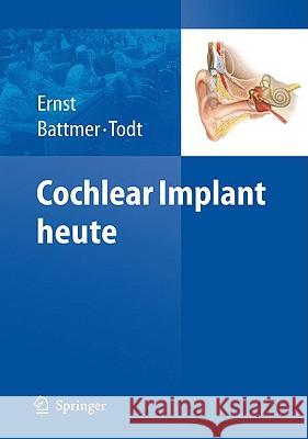 Cochlear Implant Heute Ernst, Arne 9783540882350 Springer