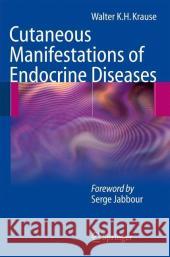 Cutaneous Manifestations of Endocrine Diseases Walter K. H. Krause 9783540883661 Springer