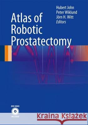 Atlas of Robotic Prostatectomy Hubert John Peter Wiklund Jarn H. Witt 9783540884071 Not Avail