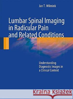 Lumbar Spinal Imaging in Radicular Pain and Related Conditions: Understanding Diagnostic Images in a Clinical Context Wilmink, J. T. 9783540938293 Springer