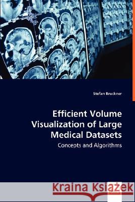 Efficient Volume Visualization of Large Medical Datasets - Concepts and Algorithms Stefan Bruckner 9783639009088 VDM VERLAG DR. MULLER AKTIENGESELLSCHAFT & CO