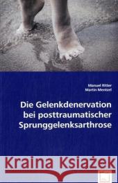 Die Gelenkdenervation bei posttraumatischer Sprunggelenksarthrose : Species, Shrub, Mangrove Ritter, Manuel; Mentzel, Martin 9783639014969