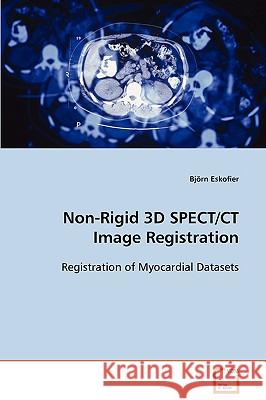 Non-Rigid 3D SPECT/CT Image Registration Björn Eskofier 9783639089851