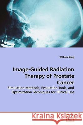 Image-Guided Radiation Therapy of Prostate Cancer William Song 9783639153927 VDM Verlag