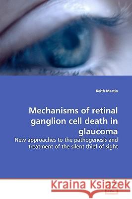 Mechanisms of retinal ganglion cell death in glaucoma Martin, Keith 9783639161656 VDM Verlag