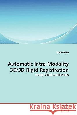 Automatic Intra-Modality 3D/3D Rigid Registration Dieter Hahn 9783639181111 VDM Verlag