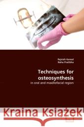 Techniques for osteosynthesis Kansal, Rajnish 9783639340655