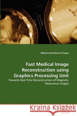 Fast Medical Image Reconstruction using Graphics Processing Unit Haque, Mohammad Nazmul 9783639376777 VDM Verlag