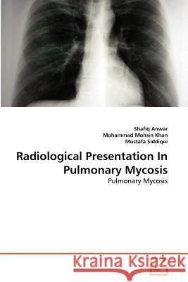 Radiological Presentation In Pulmonary Mycosis Anwar, Shafiq 9783639378801 VDM Verlag