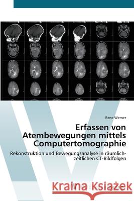 Erfassen von Atembewegungen mittels Computertomographie Werner, Rene 9783639406757 AV Akademikerverlag