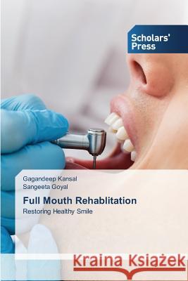 Full Mouth Rehablitation Kansal Gagandeep                         Goyal Sangeeta 9783639516562