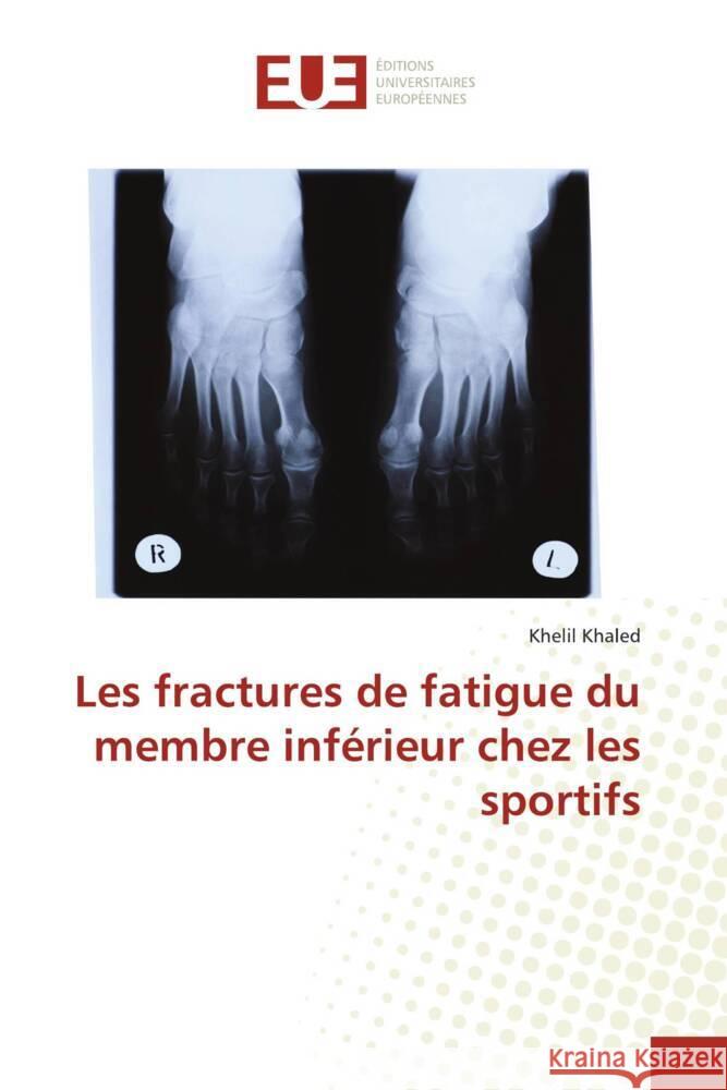 Les fractures de fatigue du membre inférieur chez les sportifs Khaled, Khelil 9783639524628