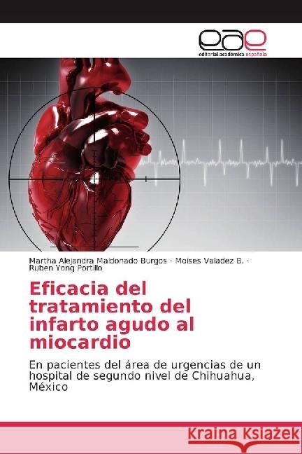 Eficacia del tratamiento del infarto agudo al miocardio : En pacientes del área de urgencias de un hospital de segundo nivel de Chihuahua, México Maldonado Burgos, Martha Alejandra; Valadez B., Moises; Yong Portillo, Ruben 9783639537765 Editorial Académica Española