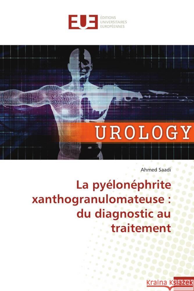 La pyélonéphrite xanthogranulomateuse : du diagnostic au traitement Saadi, Ahmed 9783639548846