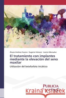 El tratamiento con implantes mediante la elevación del seno maxilar Jiménez Guerra Álvaro 9783639550702