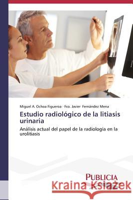 Estudio radiológico de la litiasis urinaria Ochoa Figueroa Miguel a. 9783639551372