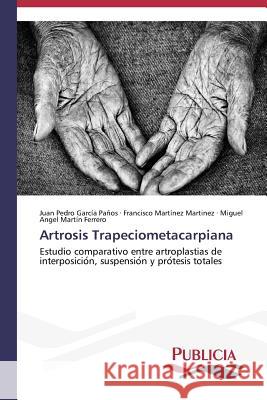 Artrosis Trapeciometacarpiana Garcia Paños Juan Pedro 9783639551471