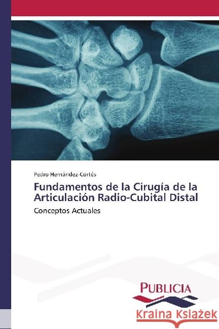 Fundamentos de la Cirugía de la Articulación Radio-Cubital Distal : Conceptos Actuales Hernández-Cortés, Pedro 9783639551662