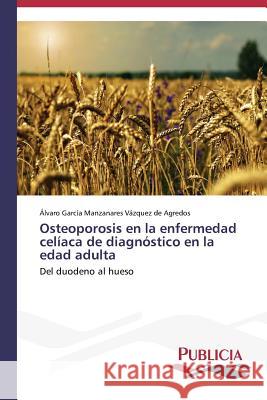 Osteoporosis en la enfermedad celíaca de diagnóstico en la edad adulta Garcia Manzanares Vazquez de Agredos 9783639556605