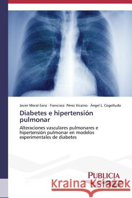 Diabetes e hipertensión pulmonar Moral-Sanz, Javier 9783639558975