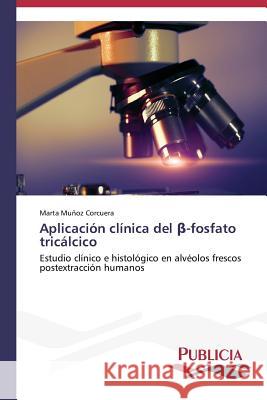 Aplicación clínica del β-fosfato tricálcico Muñoz Corcuera, Marta 9783639559460