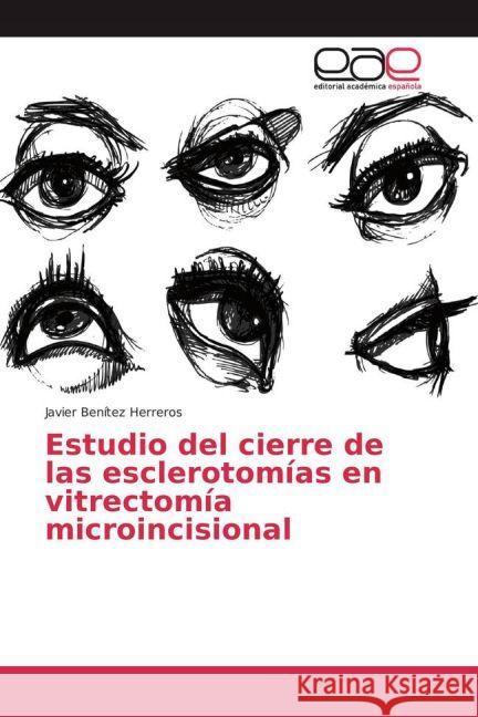 Estudio del cierre de las esclerotomías en vitrectomía microincisional Benítez Herreros, Javier 9783639603392