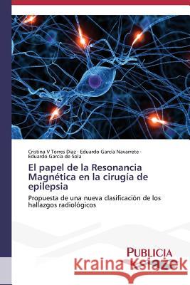 El papel de la Resonancia Magnética en la cirugía de epilepsia Torres Diaz, Cristina V. 9783639645668