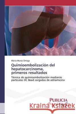 Quimioembolización del hepatocarcinoma, primeros resultados Muros Ortega, Maria 9783639648379