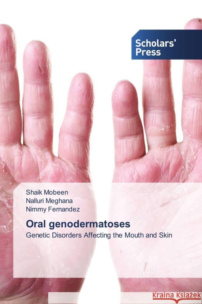 Oral genodermatoses Mobeen, Shaik, Meghana, Nalluri, Fernandez, Nimmy 9783639668124 Scholars' Press