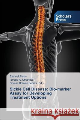 Sickle Cell Disease: Bio-marker Assay for Developing Treatment Options Atabo Samuel                             Umar Ismaila a.                          James Dorcas Bolanle 9783639669138 Scholars' Press