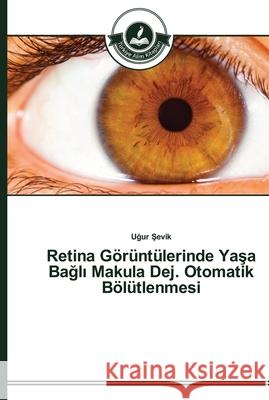 Retina Görüntülerinde Yaşa Bağlı Makula Dej. Otomatik Bölütlenmesi Şevik, Uğur 9783639670639 Türkiye Alim Kitaplar